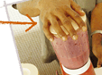 MixerLid Operation